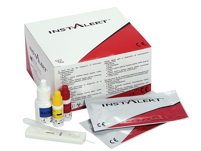 TEST MONONUCLEOSI