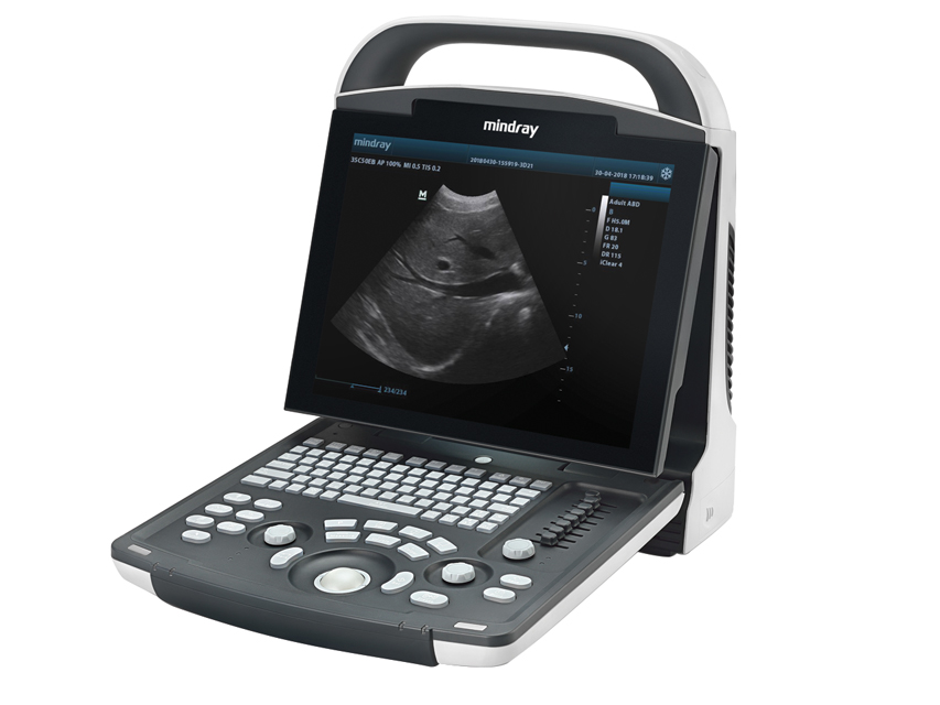 NUOVO ECOGRAFO MINDRAY DP-20