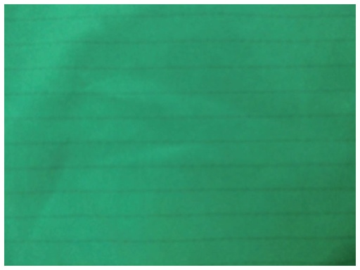 [41011] TELINO CHIRURGICO IN MICROFIBRA 250x150cm - verde